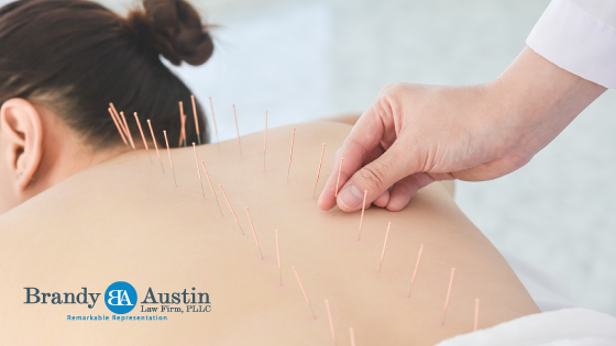 Woman getting acupuncture 