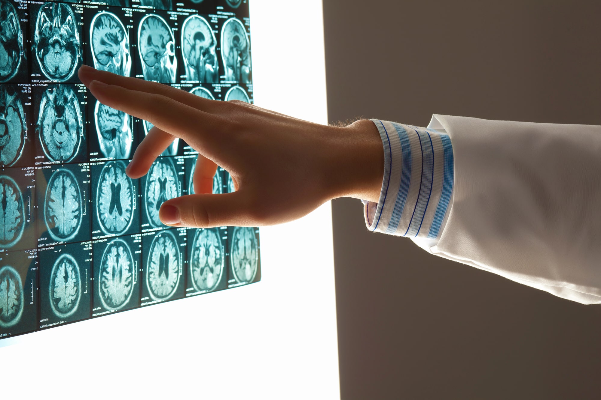 Brain injury lawyer Grand Prairie, TX