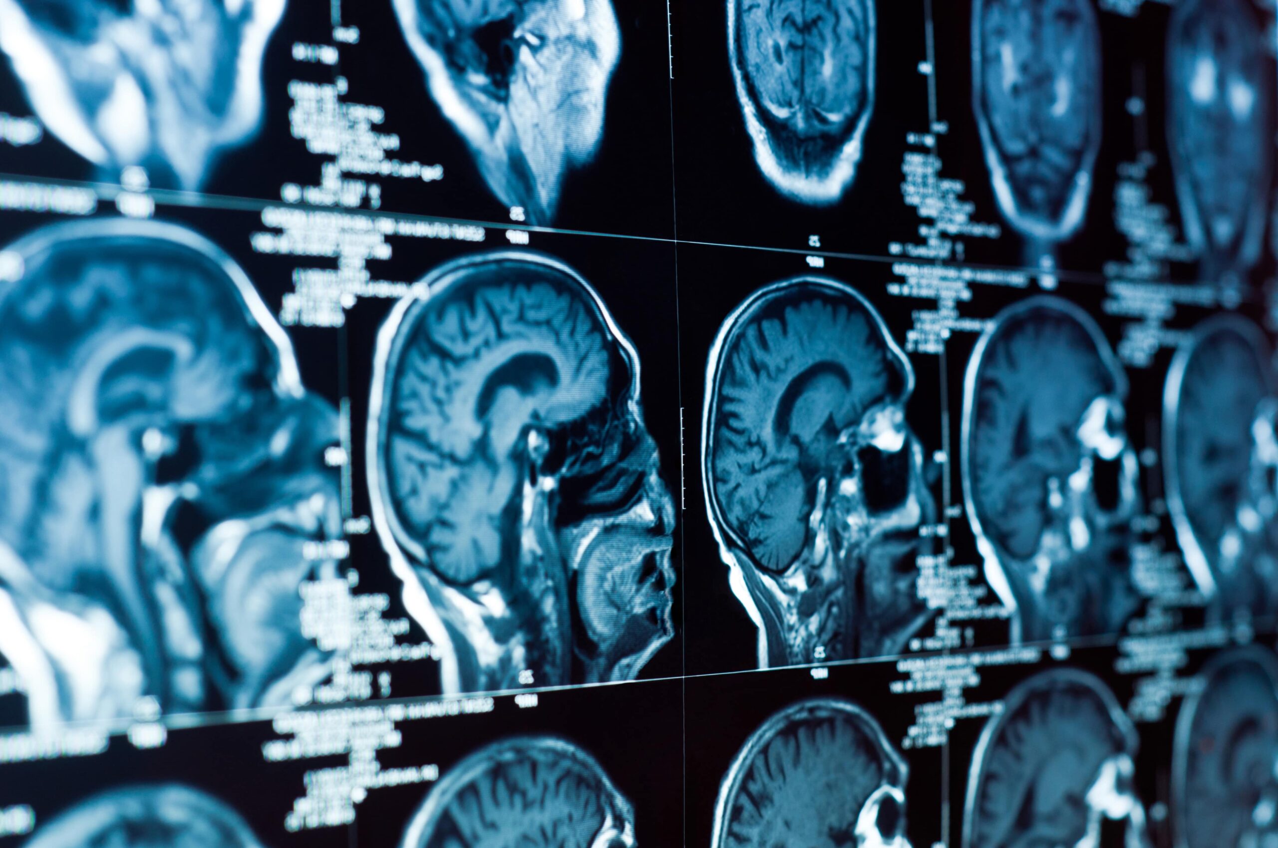 brain Injury lawyer in Grand Prairie, TX
